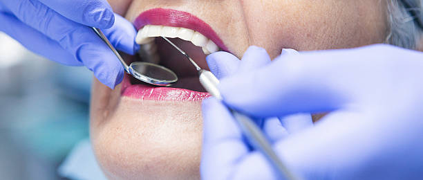 Best Emergency Root Canal Treatment in Brockton, MA